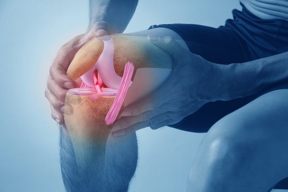 An athlete holding a painful knee that will not fully straighten after a twisting injury