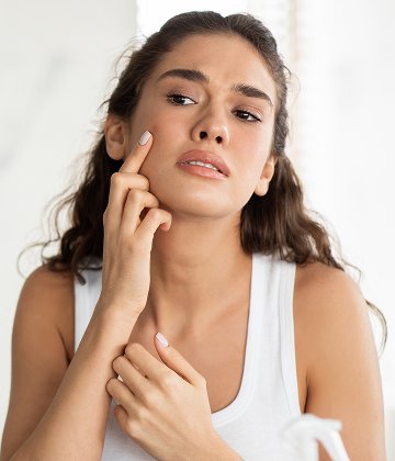 Skin Conditions