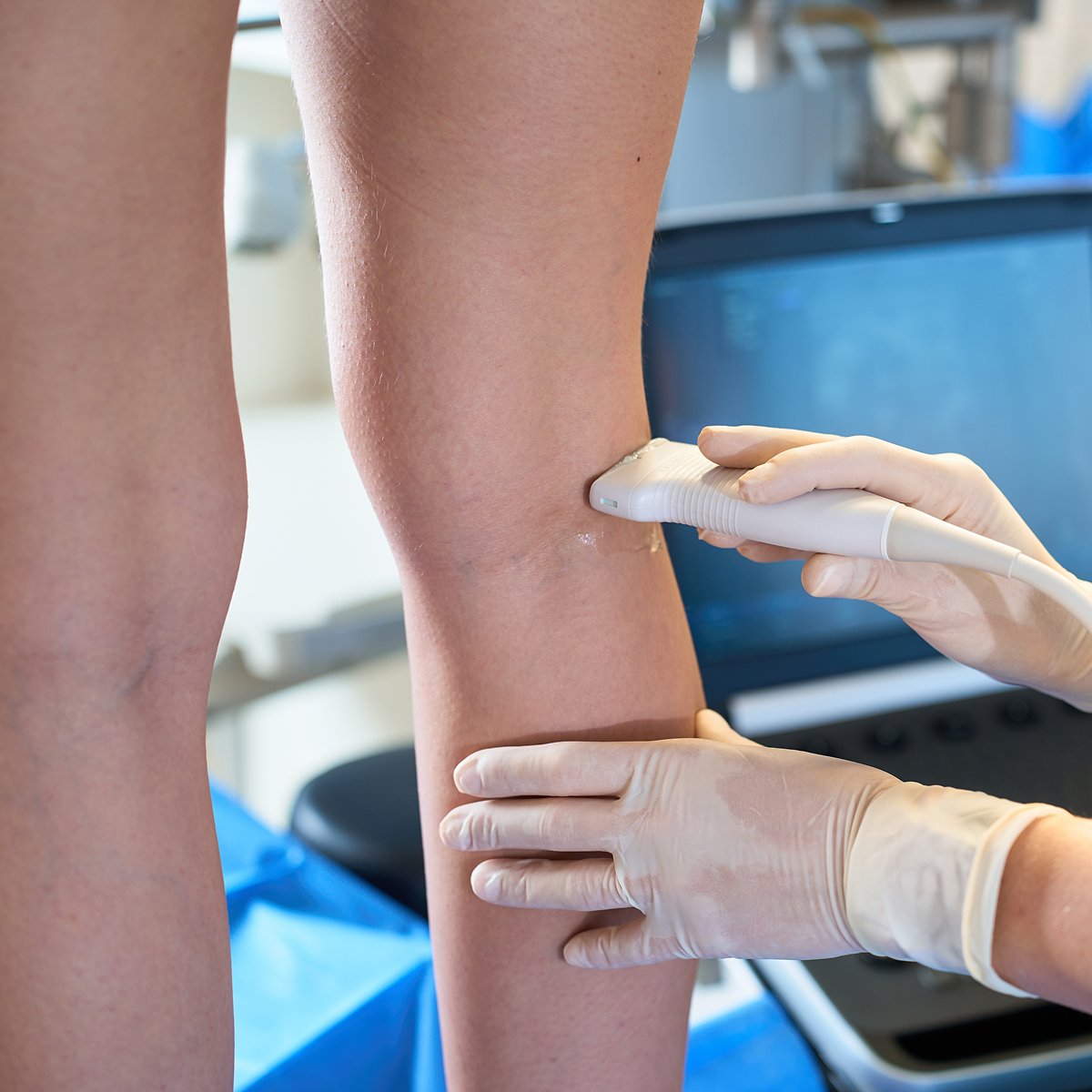 Venous & Vascular Screening