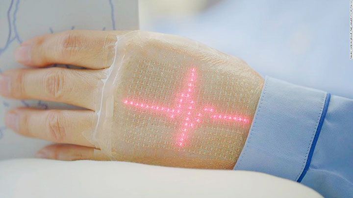 Da điện tử sẽ là tương lai của sản phẩm theo dõi sức khỏe và thiết bị y tế