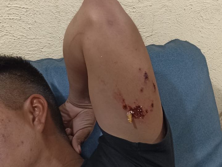 Soldado herido por explosiones de normalistas