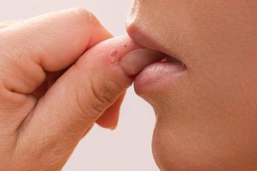 Las consecuencias de morderse las uñas; ¿cómo dejar de hacerlo?