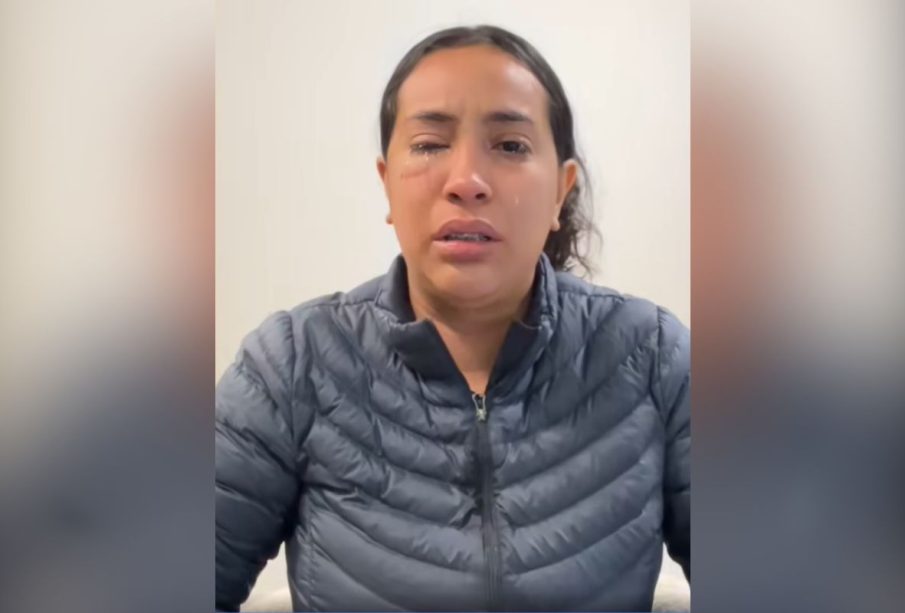 Ataque con ácido es denunciado por joven mujer en Tijuana