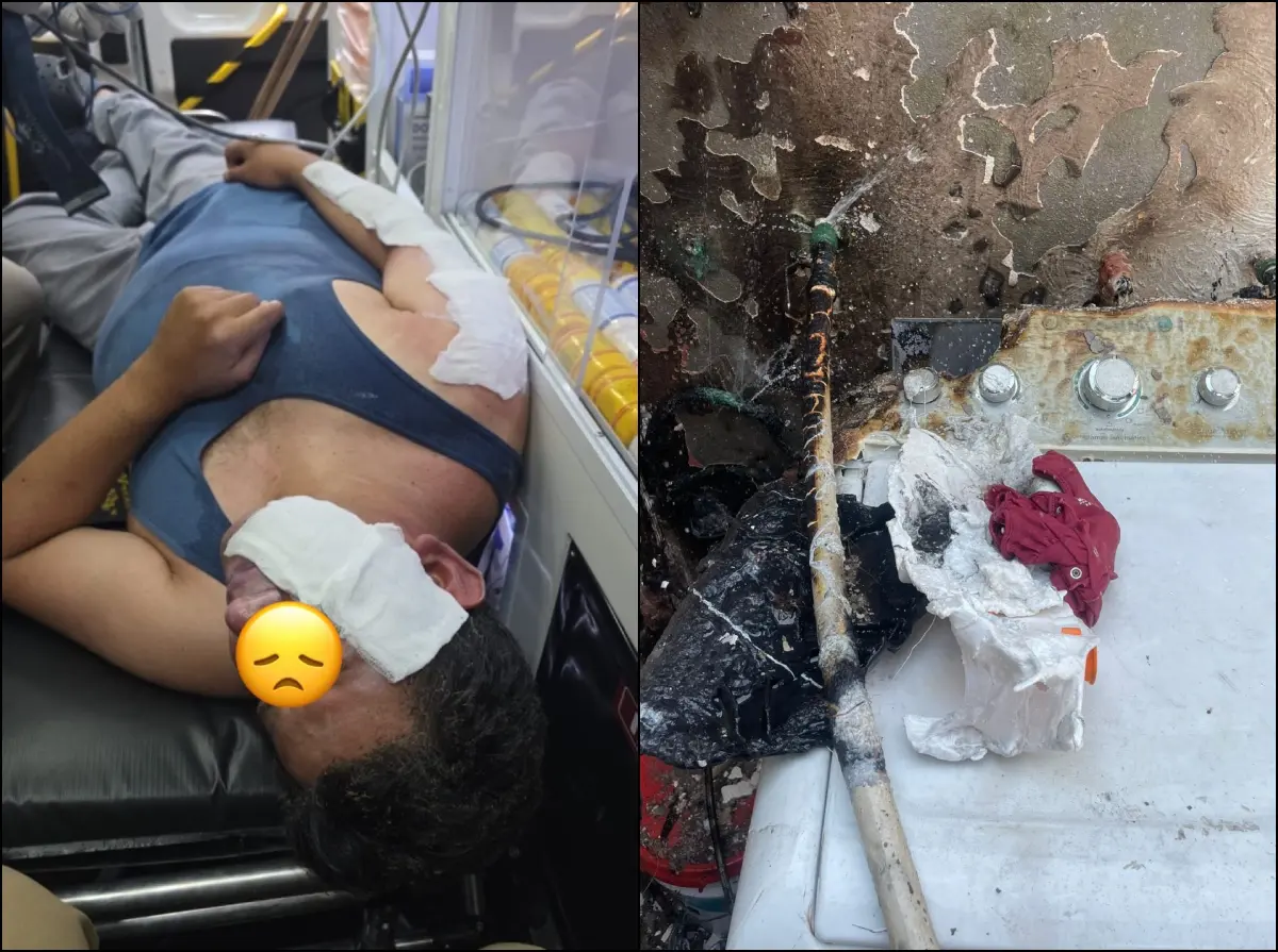 Hombre sufre quemaduras en rostro por tanque de gas en Altavela