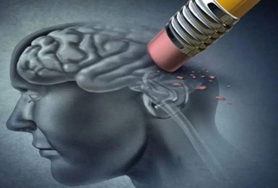 Inteligencia artificial Alzhéimer