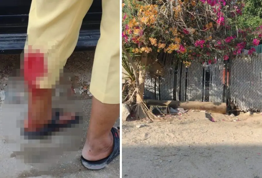 Adulto mayor atacado por un perro en la colonia El Caribe en CSL.