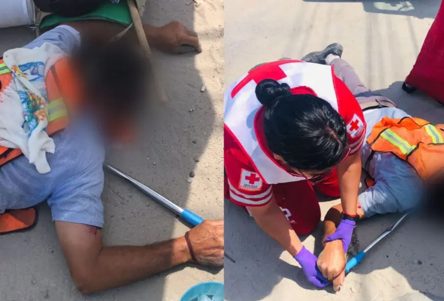 Persona atropellada en la avenida Leona Vicario.