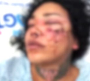 Paolita Suárez en el hospital tras golpiza