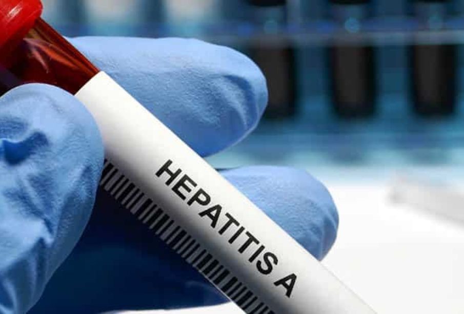 Alerta por hepatitis A en Cabo San Lucas: Se confirman 25 casos