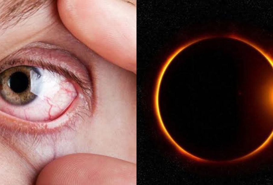 Ojo y eclipse solar