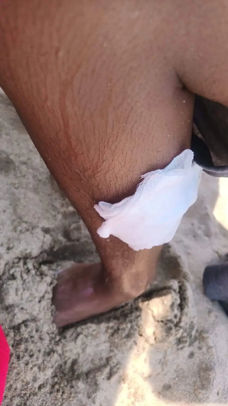 Medusas "botella azul" invaden playas de Los Cabos