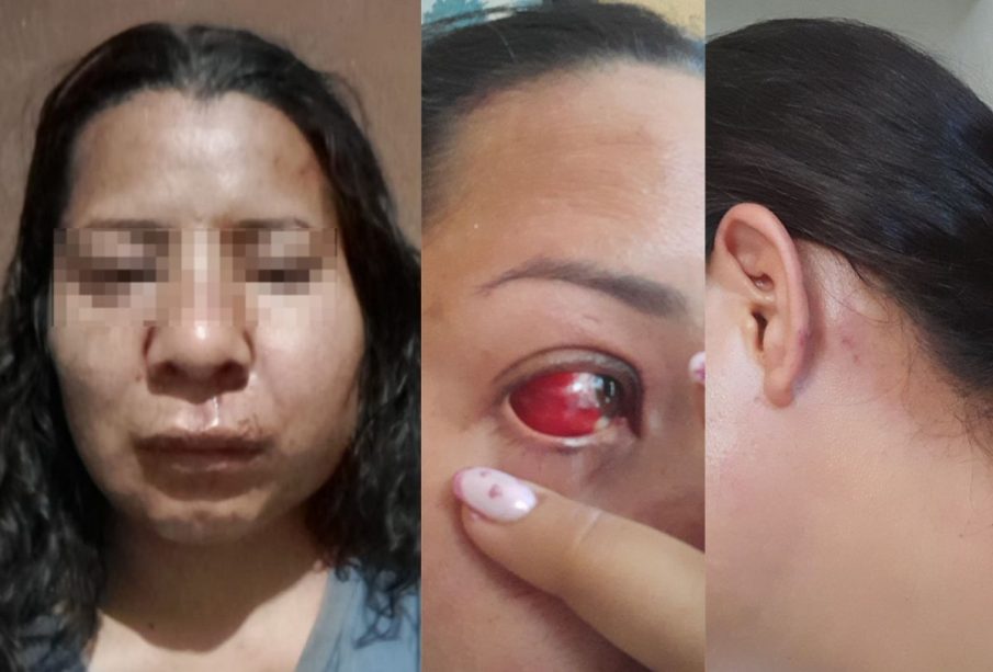 Mujer denuncia brutal golpiza