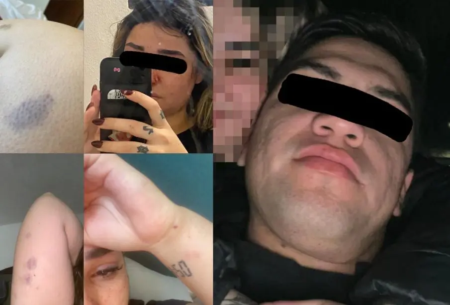Marie “N” denunció públicamente a Luis “N”, agente activo de la Policía Estatal en Baja California Sur, a quien señaló por agresión física y psicológica durante su relación.