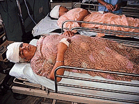 Two of the injured Mohinder Kaur and Shaminder Kaur lying in Satluj Hospital in Ludhiana