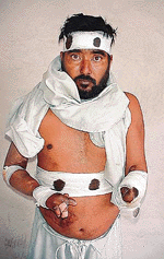 Balwant Singh shows the injuries he received to mediapersons in Ludhiana on Sunday.