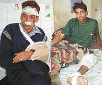 The two victims of alleged police beating at the Civil Hospital Ludhiana, on Monday.