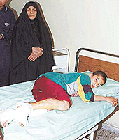 Hussein Ali (13) lies on a bed in Yarmouk Hospital in baghdad on Friday after he was injured during a U S and British air strike. 