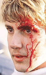 A protester bleeds as he is arrested after violence flared up when a group of protesters broke through the security cordon around the site of the summit of the Americas.