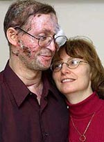 Harry Waizer, a World Trade Center burn victim, embraces his wife Karen 