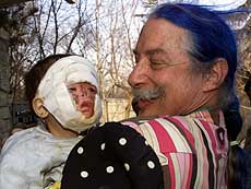 Renowned American clown-doctor Patch Adams -- immortalised in a Hollywood film starring Robin Williams -- jokes with Fahim, an injured baby at the Indira Gandhi Hospital in Kabul on Wednesday.