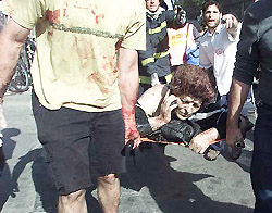 An injured woman makes a phone call as she is rushed to an ambulance
