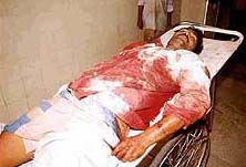 Sanjay, a close associate of underworld don Chhota Rajan, who was killed in an encounter