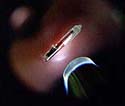 The VeriChip, which is magnified on a finger, will be implanted for the first time in a family