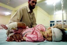 Eighteen-month-old Shehnaz from Poonch town, injured during cross-border shelling, lies in a hospital