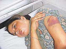Charanjit Kaur, six-month pregnant and a victim of alleged police brutaliy 