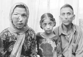 Lavdi Ram of Bharmour in Chamba, with his daughters