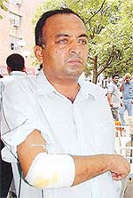 Head Constable Surinder Pal who was allegedly assaulted by an SI at the Police Lines, Sector 42, Chandigarh, on Tuesday.
