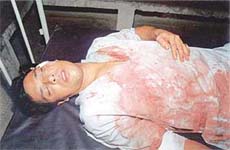 Ashutosh Vinayak in Civil Hospital, Ahmedgarh, on Saturday.