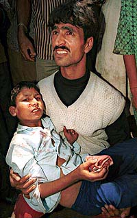 Firdous, a young boy who was injured in a clash