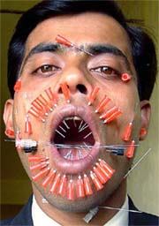Pratesh Baruah shows off his face pierced with syringes