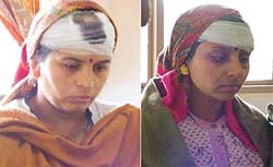 Injured relatives of a scrap dealer, Rattan Pal Maudgil, who were beaten up by a group of 25 persons