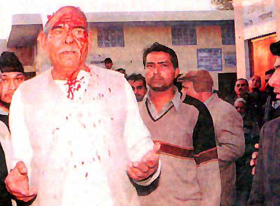BKU chief Mahender Singh Tikait injured in a clash 
