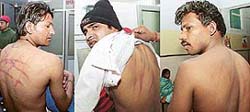 Sanjiv, Vipin and Roshan Lal, victims of alleged torture by the Jalandhar police, were admitted to General Hospital, Sector 16, late in the night 