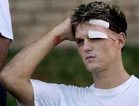 Zimbabwean batsman Mark Vermeulen holds his head after being hit by a bouncer 