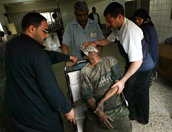 A wounded Iraqi person being taken to a hospital in Baghdad following an US air strike 