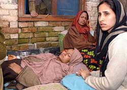 A woman,  who was wounded during a militant attack
