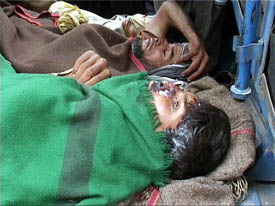 Persons whose noses were chopped off by militants lie in a hospital