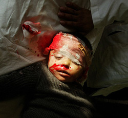 The body of a two-year-old Palestinian boy, Amir Ayyad, lies in blankets