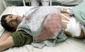 An injured Ghulam Qadir rests on a hospital bed in Srinagar