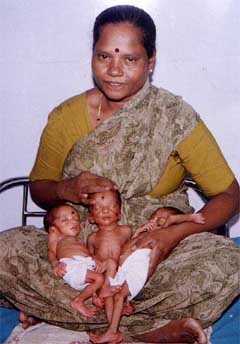 Renuka Laxman of Hubli, Karnataka, who gave birth to healthy triplets