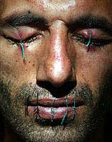 Iranian asylum-seeker Abas Amini sits with his eyes, mouth and ears sewn up