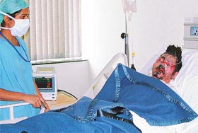 19-year-old Sri Bhagwan in a critical condition at the Fortis hospital after sustaining 75 per cent burns in Wednesday night's fire at the Ranbaxy plant in SAS Nagar