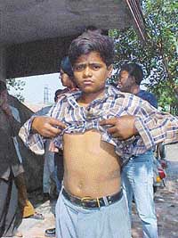 Mohammad Rasil, a child labourer who was rescued from illegal confinement by the police