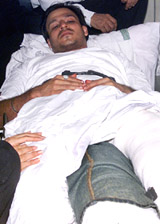 Bollywood star Vivek Oberoi in a Mumbai hospital following a motor cycle accident on Thursday. 