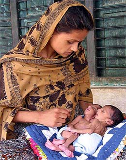 Salma Bibi holds her 10-day-old conjoined twin daughters