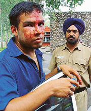 Deepak Singh Gahlawat who was injured in the fracas at Panjab University on Friday.